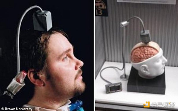 脑机接口首次人体试验  马斯克向“超级人类”前进一小步